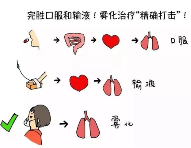 儿童雾化器怎么使用儿童雾化吸入治疗要注意的细节，看完你就明白了_https://www.jmylbn.com_新闻资讯_第4张