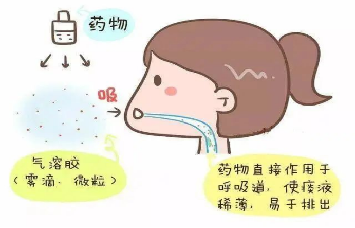 儿童雾化器怎么使用儿童雾化吸入治疗要注意的细节，看完你就明白了_https://www.jmylbn.com_新闻资讯_第3张